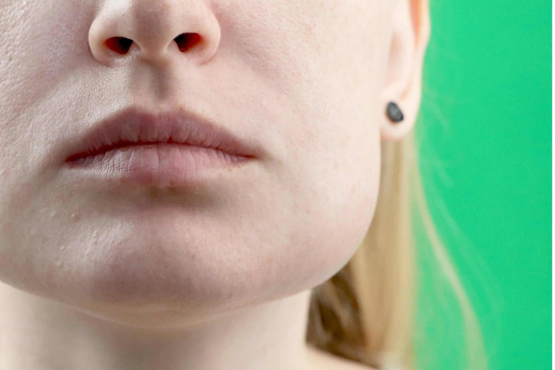 顔 が むくむ 原因